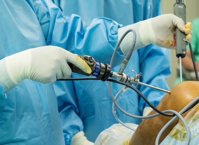 Arthroscopy - operation for arthrosis of the knee joint