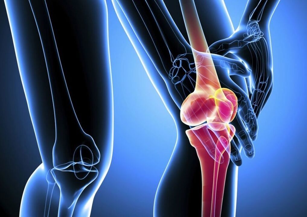 Pain during physical activity in arthrosis of the knee joint