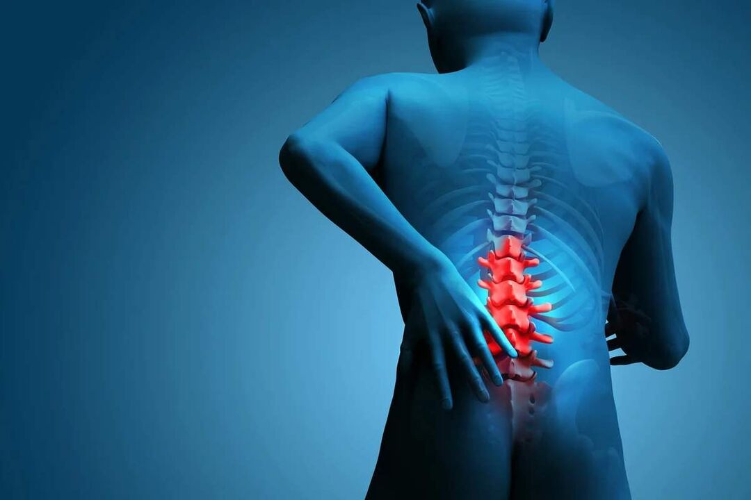 The main symptom of osteochondrosis of the lumbar spine is back pain. 
