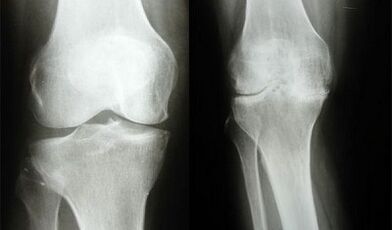 Kniediagnosten methods