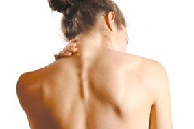 Neck pain with cervical osteochondrosis