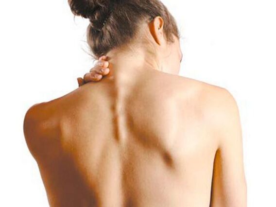 The girl suffers from cervical osteochondrosis