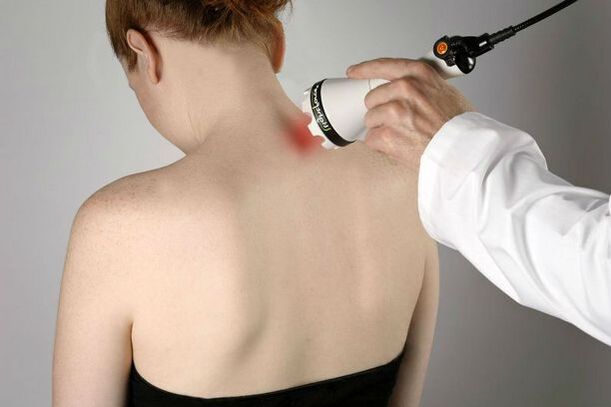 physiotherapeutic measures for the treatment of cervical osteochondrosis