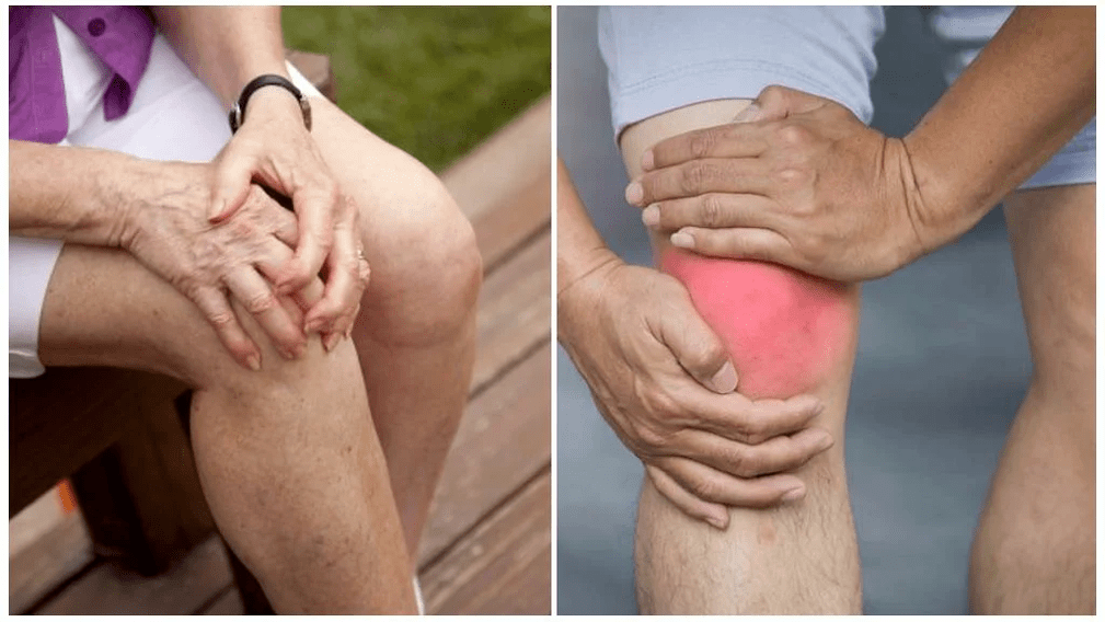 Osteoarthritis treatment