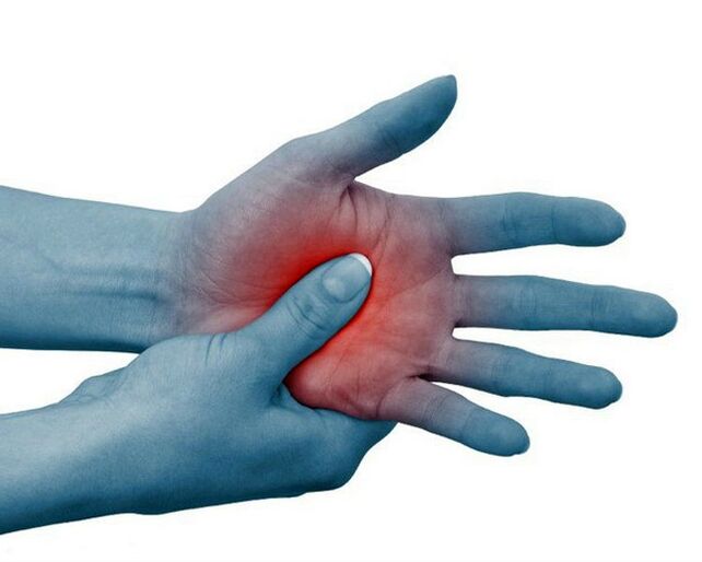 Severe pain in the finger joints that eases with physical activity is a typical sign of rheumatoid arthritis.